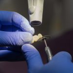 Co trzeba wiedzieć o implantach zębowych?