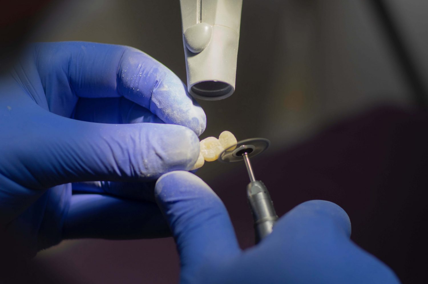 Co trzeba wiedzieć o implantach zębowych?