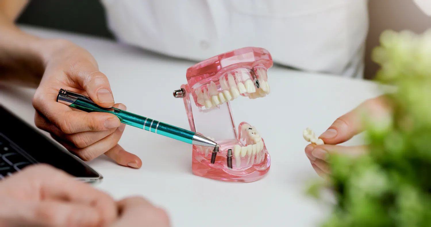 Zabiegi dentystyczne refundowane przez NFZ